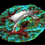 DTI statistical segmentation shown with a 3D model of the ventricles