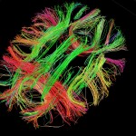 White matter fiber architecture of the brain. Measured from diffusion spectrum imaging (DSI). Shown is a thick axial section including the cingulum, forceps, and short association pathways. The fibers are color-coded by direction: red = left-right, green = anterior-posterior, blue = through brain stem. www.humanconnectomeproject.org