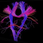 White matter fiber architecture of the brain. Measured from diffusion spectrum imaging (DSI). Shown are crossing fibers from the corpus callosum and corticospinal tract. The fibers are color-coded by direction: red = left-right, green = anterior-posterior, blue = through brain stem. www.humanconnectomeproject.org