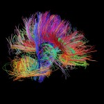 White matter fiber architecture of the brain. Measured from diffusion spectrum imaging (DSI). Shown are the corpus callosum, cerebellum, and others. The fibers are color-coded by direction: red = left-right, green = anterior-posterior, blue = through brain stem. www.humanconnectomeproject.org