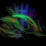 White matter fiber architecture of the brain. Measured from diffusion spectrum imaging (DSI). Shown are the corona radiata and external capsule. The fibers are color-coded by direction: red = left-right, green = anterior-posterior, blue = through brain stem. www.humanconnectomeproject.org