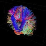 White matter fiber architecture of the brain. Measured from diffusion spectrum imaging (DSI). Shown is a thick coronal section of tracks  through the corticospinal tract. The fibers are color-coded by direction: red = left-right, green = anterior-posterior, blue = through brain stem. www.humanconnectomeproject.org