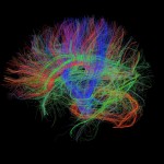 White matter fiber architecture of the brain. Measured from diffusion spectrum imaging (DSI). Shown are whole brain fibers. The fibers are color-coded by direction: red = left-right, green = anterior-posterior, blue = through brain stem. www.humanconnectomeproject.org