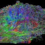 HARDI (high angular resolution diffusion imaging) tracks: Information transfer between left and right hemispheres. Image by David Shattuck, PhD. and Paul M. Thompson, PhD.