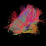 White matter fiber architecture of the brain. Measured from spectrum imaging (DSI). Shown is the corpus cdiffusionallosum. The fibers are color-coded by direction: red = left-right, green = anterior-posterior, blue = through brain stem. www.humanconnectomeproject.org