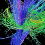White matter fiber architecture of the brain. Measured from diffusion spectrum imaging (DSI). Shown are fibers from the internal and external capsule. The fibers are color-coded by direction: red = left-right, green = anterior-posterior, blue = through brain stem. www.humanconnectomeproject.org