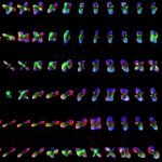 The orientation distribution function (ODF) computed in high angular resolution diffusion imaging (HARDI) provides for the presence of multiple fiber populations at each voxel. Software: DIRAC. Image by Vishal Patel, PhD.