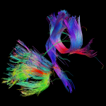 White matter fiber architecture of the brain. Measured from diffusion spectrum imaging (DSI). Shown are the forceps minor, corpus callosum, and a brainstem projection. The fibers are color-coded by direction: red = left-right, green = anterior-posterior, blue = through brain stem. www.humanconnectomeproject.org