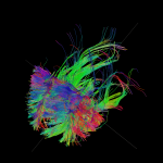 White matter fiber architecture of the brain. Measured from diffusion spectrum imaging (DSI). Shown are frontal projection fibers including the cingulum, anterior thalamic radiation, and forceps minor. The fibers are color-coded by direction: red = left-right, green = anterior-posterior, blue = through brain stem. www.humanconnectomeproject.org