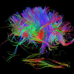 White matter fiber architecture of the brain. Measured from diffusion spectrum imaging (DSI). Shown is the cingulum bundle resting atop the corpus callosum. The fibers are color-coded by direction: red = left-right, green = anterior-posterior, blue = through brain stem. www.humanconnectomeproject.org