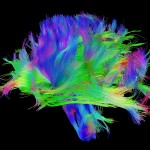 White matter fiber architecture from the Connectome Scanner dataset. Shown are the corona radiata and inferior fronto-occipital fasciculus.  The fibers are color-coded by direction: red = left-right, green = anterior-posterior, blue = ascending-descending (RGB=XYZ). www.humanconnectomeproject.org