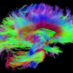 White matter fiber architecture from the Connectome Scanner dataset. Shown are the corpus calllosum and brainstem pathways.  The fibers are color-coded by direction: red = left-right, green = anterior-posterior, blue = ascending-descending (RGB=XYZ). www.humanconnectomeproject.org