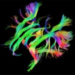 White matter fiber architecture from the Connectome Scanner dataset. Shown are association pathways connecting cortical areas. The fibers are color-coded by direction: red = left-right, green = anterior-posterior, blue = ascending-descending (RGB=XYZ). www.humanconnectomeproject.org