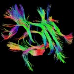 White matter fiber architecture from the Connectome Scanner dataset. Shown are association pathways connecting cortical areas. The fibers are color-coded by direction: red = left-right, green = anterior-posterior, blue = ascending-descending (RGB=XYZ). www.humanconnectomeproject.org
