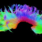 White matter fiber architecture from the Connectome Scanner dataset. Shown are commissural connections.  The fibers are color-coded by direction: red = left-right, green = anterior-posterior, blue = ascending-descending (RGB=XYZ). www.humanconnectomeproject.org