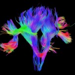 White matter fiber architecture of the brain. Measured from diffusion spectrum imaging (DSI). Shown are association and projection fibers. The fibers are color-coded by direction: red = left-right, green = anterior-posterior, blue = through brain stem. www.humanconnectomeproject.org