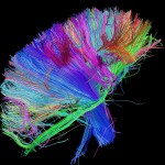 White matter fiber architecture of the brain. Measured from diffusion spectrum imaging (DSI). Featured on the cover of he 2nd Law by the band Muse.  The fibers are color-coded by direction: red = left-right, green = anterior-posterior, blue = through brain stem. www.humanconnectomeproject.org