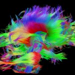 White matter fiber architecture of the brain. Measured from diffusion spectrum imaging (DSI).  Shown are the corpus calllosum and brainstem pathways.  The fibers are color-coded by direction: red = left-right, green = anterior-posterior, blue = ascending-descending (RGB=XYZ). www.humanconnectomeproject.org