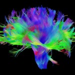 White matter fiber architecture of the brain. Measured from diffusion spectrum imaging (DSI). Shown are the corona radiata and external capsule. The fibers are color-coded by direction: red = left-right, green = anterior-posterior, blue = through brain stem. www.humanconnectomeproject.org