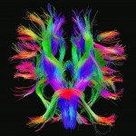 White matter fiber architecture of the brain. Measured from diffusion spectrum imaging (DSI). Shown is a complex combination of brainstem pathways, thalamic radiation, and short association fibers. The fibers are color-coded by direction: red = left-right, green = anterior-posterior, blue = through brain stem. www.humanconnectomeproject.org